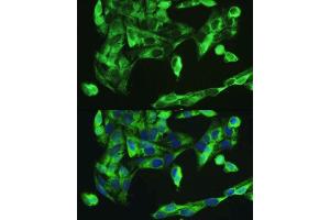 Immunofluorescence analysis of U2OS cells using BMP2 antibody. (BMP2 anticorps  (AA 283-396))