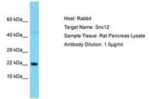 Image no. 1 for anti-Sorting Nexin 12 (SNX12) (AA 86-135) antibody (ABIN6750493) (SNX12 anticorps  (AA 86-135))
