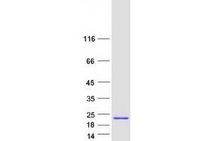 Validation with Western Blot