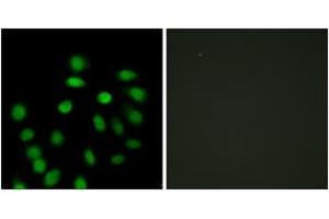 Immunofluorescence analysis of HepG2 cells, using SCAND1 Antibody.