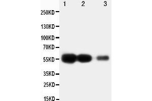 Anti-RAGE antibody, Western blotting Lane 1: Recombinant Human RAGE Protein 10ng Lane 2: Recombinant Human RAGE Protein 5ng Lane 3: Recombinant Human RAGE Protein 2. (RAGE anticorps  (Middle Region))