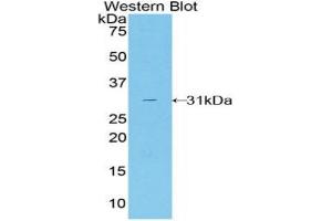 Western blot analysis of recombinant Mouse TALDO1. (TALDO1 anticorps  (AA 35-285))