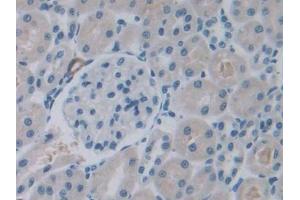 IHC-P analysis of Rat Kidney Tissue, with DAB staining. (ROS1 anticorps  (AA 1937-2210))