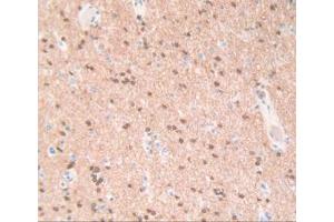 IHC-P analysis of Human Brain Tissue, with DAB staining. (QDPR anticorps  (AA 1-244))