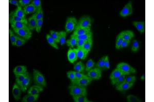 Immunofluorescence staining of HepG2 cells with ABIN7159352 at 1:133, counter-stained with DAPI. (MAGI1 anticorps  (AA 1234-1367))