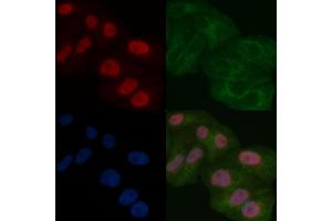 SAP62 Mouse Monoclonal Antibody staining Hela cells by IF/ICC.