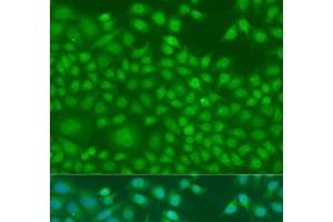 Immunofluorescence analysis of U2OS cells using NIN Polyclonal Antibody at dilution of 1:100.