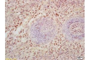 Formalin-fixed and paraffin embedded mouse embryo labeled with Rabbit Anti FOXD3 Polyclonal Antibody, Unconjugated (ABIN1387475) at 1:200 followed by conjugation to the secondary antibody and DAB staining