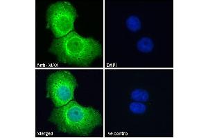 ABIN184586 Immunofluorescence analysis of paraformaldehyde fixed A431 cells, permeabilized with 0. (MAX anticorps  (C-Term))