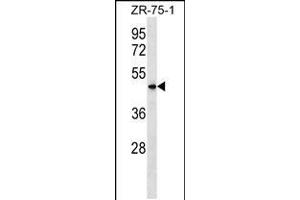 Western blot analysis in ZR-75-1 cell line lysates (35ug/lane). (VN1R5 anticorps  (AA 214-241))