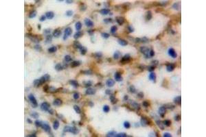 Used in DAB staining on fromalin fixed paraffin-embedded Spleen tissue (CD160 anticorps  (AA 37-154))