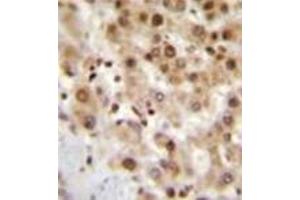 Immunohistochemistry analysis in formalin fixed and paraffin embedded human liver tissue reacted with IER3 / IEX1 Antibody (N-term) followed which was peroxidase conjugated to the secondary antibody and followed by AB staining.