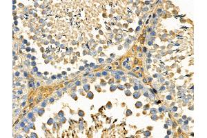 Phospho-DDR1 (Tyr180) Antibody at 1/100 staining Rat testis tissue by IHC-P.