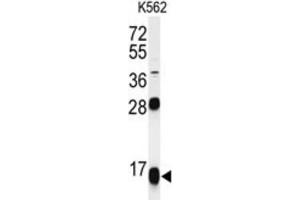 Western Blotting (WB) image for anti-Ribosomal Protein S15a (RA) antibody (ABIN3002138)