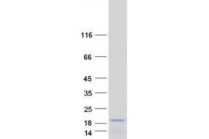 Validation with Western Blot