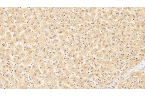 Detection of GATA2 in Human Liver Tissue using Polyclonal Antibody to GATA Binding Protein 2 (GATA2)