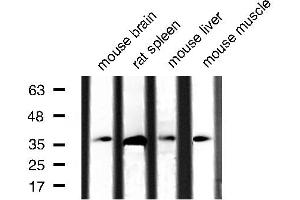 Western blot analysis of extracts of various tissue sample,using Caspase 3 Antibody . (Caspase 3 anticorps  (Internal Region))