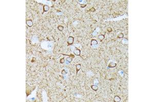 Immunohistochemistry of paraffin-embedded human brain using CaMKII Rabbit mAb (ABIN3015112, ABIN3015113, ABIN1679768 and ABIN1679769) at dilution of 1:100 (40x lens). (CAMK2B anticorps)