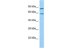 Host: Rabbit Target Name: TIGD7 Sample Type: Hela Whole Cell lysates Antibody Dilution: 1. (TIGD7 anticorps  (C-Term))