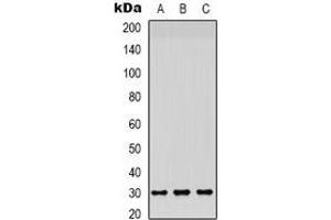 Western blot analysis of CD66c/d expression in HepG2 (A), A549 (B), mouse brain (C) whole cell lysates. (CEACAM3/6 anticorps)