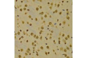 Immunohistochemistry of paraffin-embedded Mouse brain using TriMethyl-Histone H3-K9 antibody. (Histone 3 anticorps  (H3K9me3))