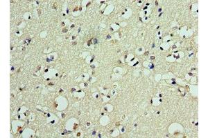 Immunohistochemistry of paraffin-embedded human brain tissue using ABIN7150359 at dilution of 1:100 (DEDD2 anticorps  (AA 1-240))
