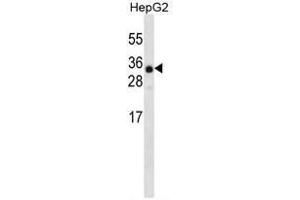 ANR46 Antibody (N-term) western blot analysis in HepG2 cell line lysates (35 µg/lane). (ANKRD46 anticorps  (N-Term))