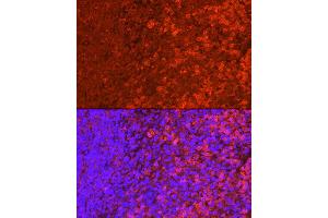 Immunofluorescence analysis of mouse spleen cells using SHIP1 Rabbit pAb (ABIN3015068, ABIN3015069, ABIN6213623 and ABIN6213625) at dilution of 1:250 (40x lens).