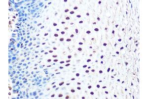 Immunohistochemistry of paraffin-embedded human esophageal using THOC4/THOC4/ALYREFREF Rabbit mAb (ABIN1679512, ABIN3018793, ABIN3018794 and ABIN7101662) at dilution of 1:100 (40x lens).