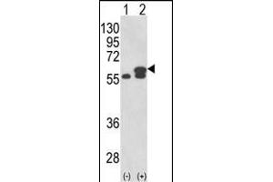 Western blot analysis of PDIA3 (arrow) using rabbit polyclonal PDIA3 Antibody (Center) (ABIN389465 and ABIN2839530). (PDIA3 anticorps  (AA 192-220))