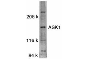 Western Blotting (WB) image for anti-Mitogen-Activated Protein Kinase Kinase Kinase 5 (MAP3K5) (C-Term) antibody (ABIN1030259) (ASK1 anticorps  (C-Term))