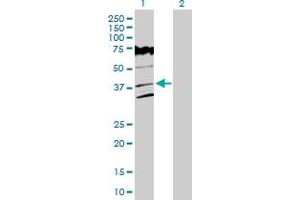 Western Blot analysis of VPS26A expression in transfected 293T cell line by VPS26A MaxPab polyclonal antibody.