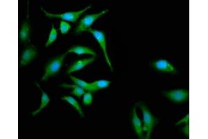 Immunofluorescence staining of Hela cells with ABIN7146380 at 1:133, counter-stained with DAPI. (CABP4 anticorps  (AA 1-107))