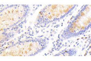 Detection of SCG3 in Human Colon Tissue using Polyclonal Antibody to Secretogranin III (SCG3)