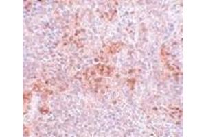 Immunohistochemistry of BFAR in mouse kidney tissue with BFAR antibody at 5 μg/ml.