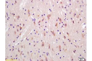 Formalin-fixed and paraffin embedded rat brain labeled with Rabbit Anti Huntingtin Polyclonal Antibody, Unconjugated (ABIN1387692) at 1:200 followed by conjugation to the secondary antibody and DAB staining (Huntingtin anticorps  (AA 751-850))