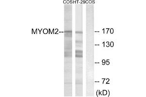 Western blot analysis of extracts from COS-7 cells and HT-29 cells, using MYOM2 antibody. (MYOM2 anticorps  (Internal Region))