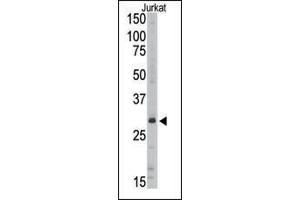 Western blot analysis of anti-SIRT5 Pab (ABIN390180 and ABIN2840671) in Jurkat cell line lysate (35 μg/lane).