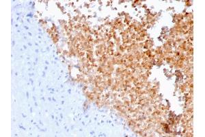 Formalin-fixed, paraffin-embedded human lung stained with Fodrin Mouse Monoclonal Antibody (SPTAN1/3352).