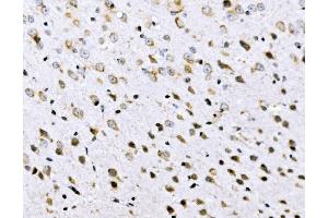 IHC analysis of VPRBP/DCAF1 using anti-VPRBP/DCAF1 antibody (ABIN7602005). (DDB1 and CUL4-Associated Factor 1 (DCAF1) (AA 540-861) anticorps)