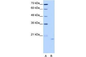WB Suggested Anti-NOL6 Antibody Titration:  2. (Nucleolar Protein 6 anticorps  (C-Term))