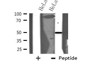 Western blot analysis of extracts from HeLa cells using MAPK10 antibody. (MAPK10 anticorps  (C-Term))