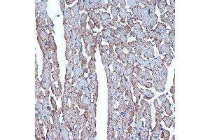 Immunohistochemistry of paraffin-embedded rat heart using CDC42EP1 Rabbit mAb (ABIN7266231) at dilution of 1:100 (40x lens). (CDC42EP1 anticorps)