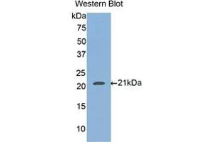 Western blot analysis of the recombinant protein. (HFE2 anticorps  (AA 234-416))