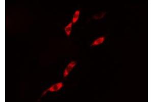 ABIN6276418 staining 293 cells by IF/ICC. (Caspase 1 anticorps  (C-Term))