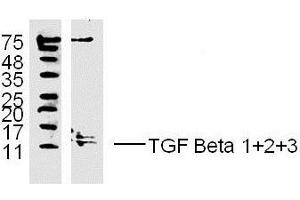 MDA-MB-231 lysates probed with TGF Beta 1+2+3 Polyclonal Antibody, unconjugated  at 1:300 overnight at 4°C followed by a conjugated secondary antibody at 1:10000 for 60 minutes at 37°C. (TGF-beta anticorps  (AA 301-350))