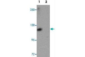 Western blot analysis of ATP11A in K-562 cell lysate with ATP11A polyclonal antibody  at 1 ug/mL in (1) the absence and (2) the presence of blocking peptide. (ATP11A anticorps  (N-Term))