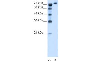 Western Blotting (WB) image for anti-Solute Carrier Family 6, Member 18 (SLC6A18) antibody (ABIN2462786) (SLC6A18 anticorps)