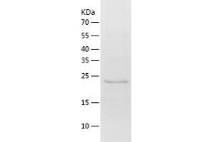 Western Blotting (WB) image for RAB21, Member RAS Oncogene Family (RAB21) (AA 2-225) protein (His tag) (ABIN7124741)