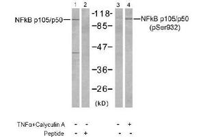 Image no. 2 for anti-Nuclear Factor of kappa Light Polypeptide Gene Enhancer in B-Cells 1 (NFKB1) (Ser932) antibody (ABIN197494)